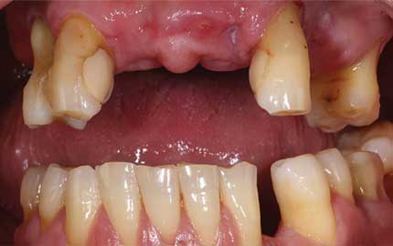 Dental before treatment
